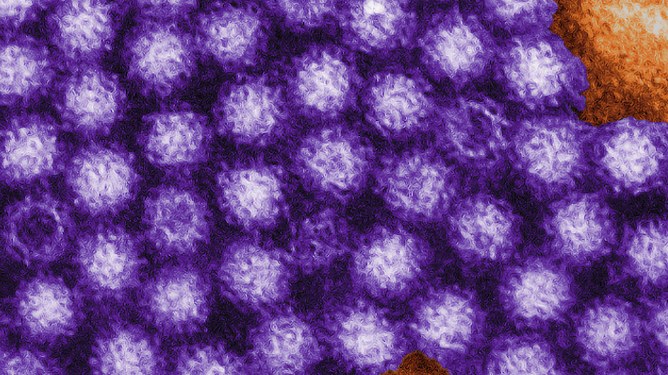 Image of norovirus particles.