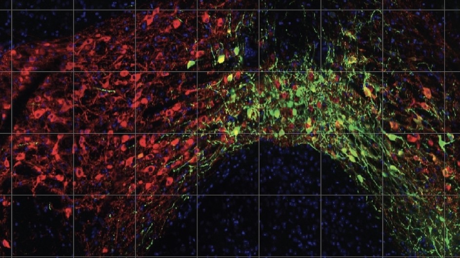 Dopamine neurons in the brain of a mouse.
