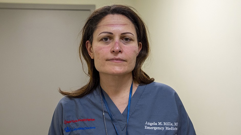 Dr. Angela Mills in scrubs looking exhausted with goggle marks on face.