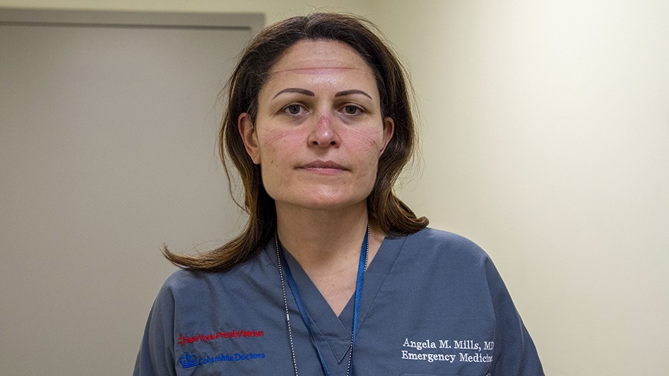 Photo by Jennifer O'Rourke for Columbia University Irving Medical Center Dr. Angela Mills in scrubs looking exhausted with goggle marks on face.