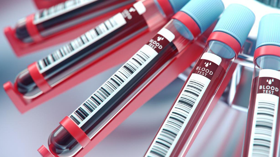 blood vials (Getty Images)