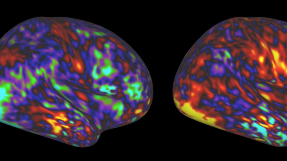 The new brain imaging study shows that parts of the TPJ—involved in the understanding of complex social scenes—are less active in people with schizophrenia. (Image: Gaurev Patel lab) fMRI brain scans