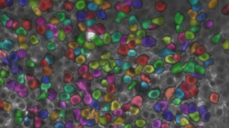 Hippocampal place cells imaged with two-photon imaging, color coded by location preference. (Andres Grosmark | Losonczy Lab | Columbia's Zuckerman Institute) hippocampal place cells (Andres Grosmark | Losonczy Lab | Columbia's Zuckerman Institute)