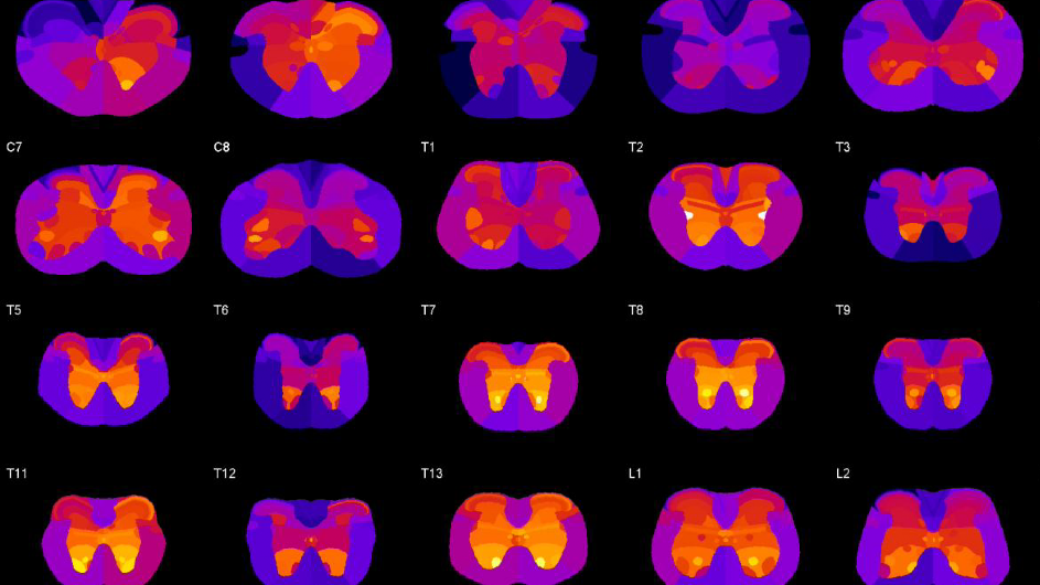 Heat maps of neurotransmitter intensities for each spinal segment. (Credit: Felix Fiederling/Mason-Dodd Lab/Columbia's Zuckerman Institute) neurotransmitter heat maps for spinal cord segments