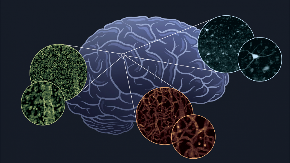 A combination of microscopy, tissue preparation and data innovations could yield first-of-their-kind brain atlases that specify the locations and types of all of the brain’s 180+ billion cells (credit: Hillman Lab / Columbia's Zuckerman Institute) brain map illustration (Zuckerman Institute)