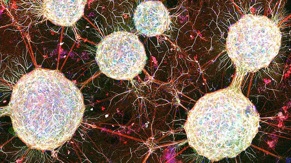 A Modular Neuronal Network (MoNNet) with interconnected spheroids, each one featuring several types of brain cells.