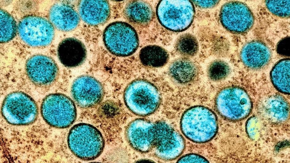 Microscope photo of the monkeypox virus, showing blue and black dots on a brown background.
