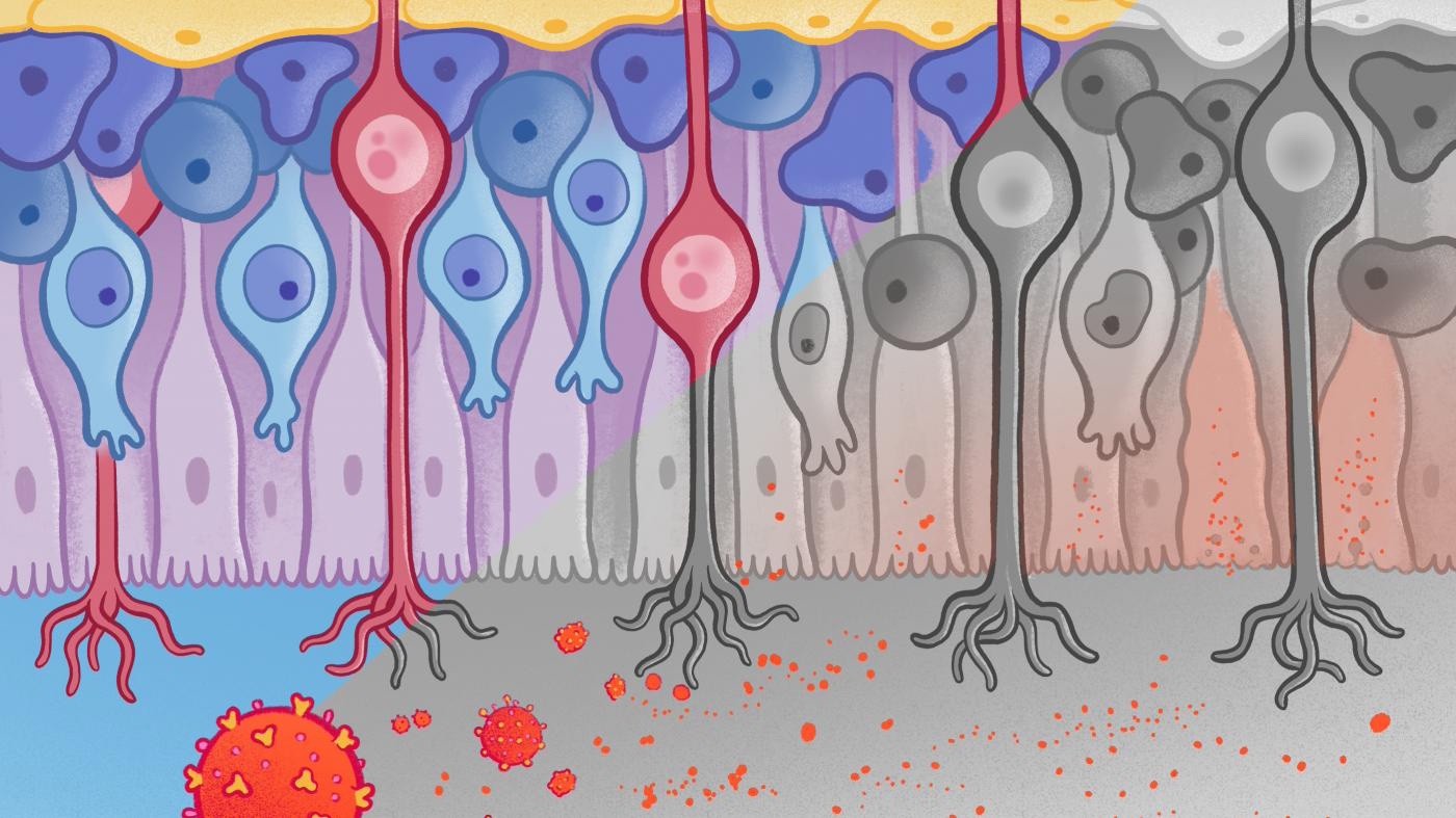 SARS-CoV-2 virus infects olfactory cells