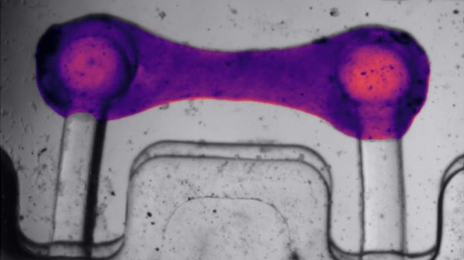 BeatProfiler, the new tool developed by Columbia biomedical engineers, in action, as seen through computer vision.