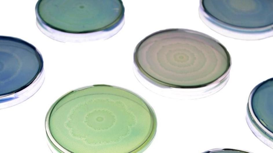Petri dishes of engineered and native Proteus mirabilis patterns.