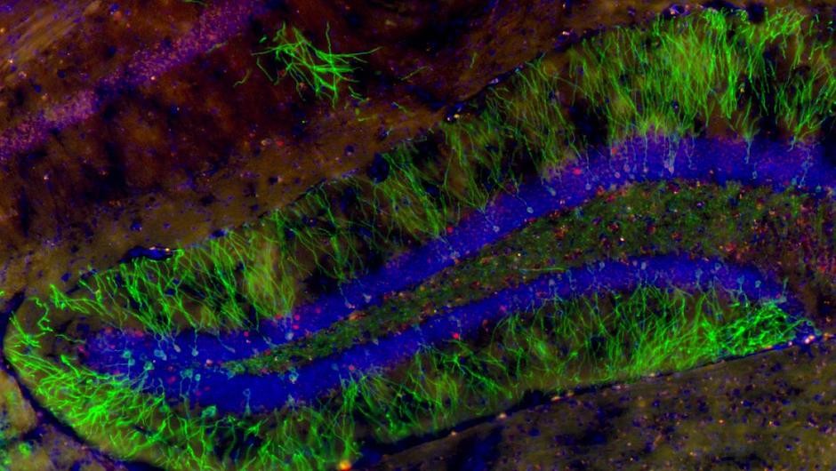 Baby neurons (green) born in the brain of an adult mouse. (Image courtesy of Alex Dranovsky.)