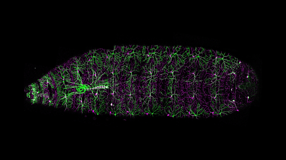 In a fruit fly larva’s body wall, sensory cells detect gentle touch (green) and noxious stimuli (magenta) (credit: Samantha Galindo / Grueber lab / Columbia’s Zuckerman Institute / Development)