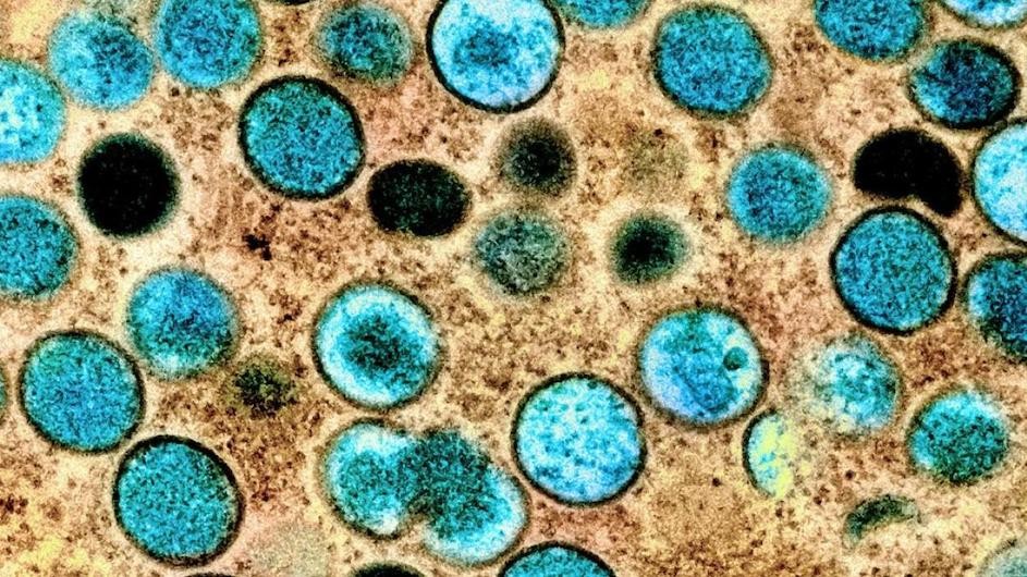 The mpox virus