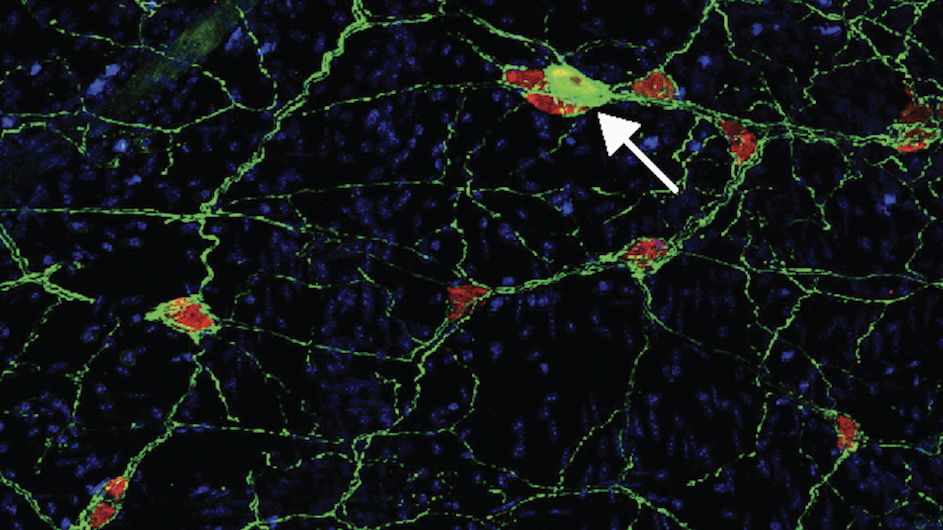 Columbia scientists have found that neurons in the gastrointestinal tract of mice are damaged by an autoimmune reaction to a protein associated with Parkinson's disease. Their study is adding to evidence that the disease may gets its start in the gut. The image includes an arrow pointing to a neuron. (Image courtesy of David Sulzer.)