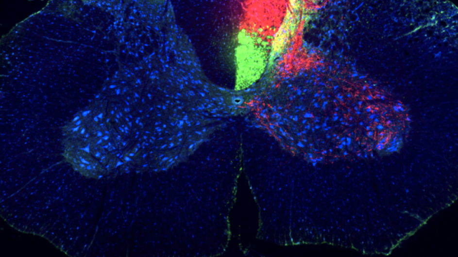 Spinal cord sensory and motor tracts