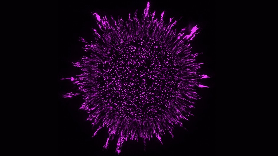 A laboratory-grown Pseudomonas aeruginosa biofilm. 3D images were acquired by an advanced light sheet theta microscopy system (ClearScope) developed in Columbia’s Department of Biological Sciences.