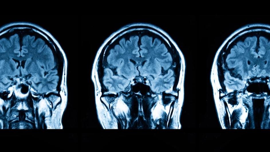 Images of patient brain scans