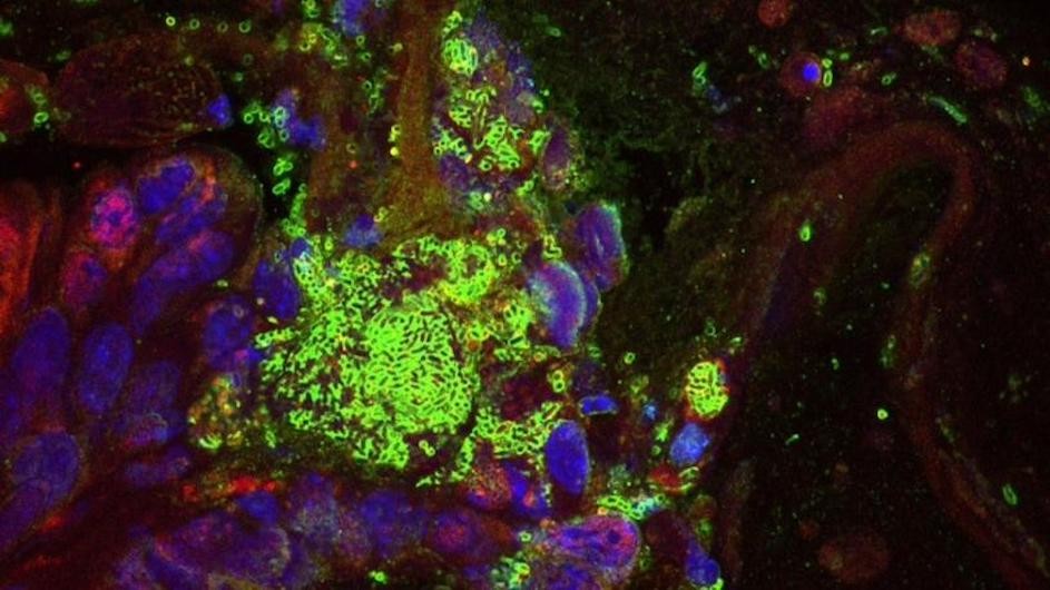 Immunofluorescent staining of colorectal cancer tumor bearing mouse fed engineered E. coli Nissle 1917 (EcN).