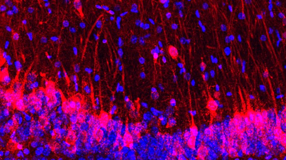 Neurons from a mouse-rat hybrid brain. Neurons from a mouse-rat hybrid brain.