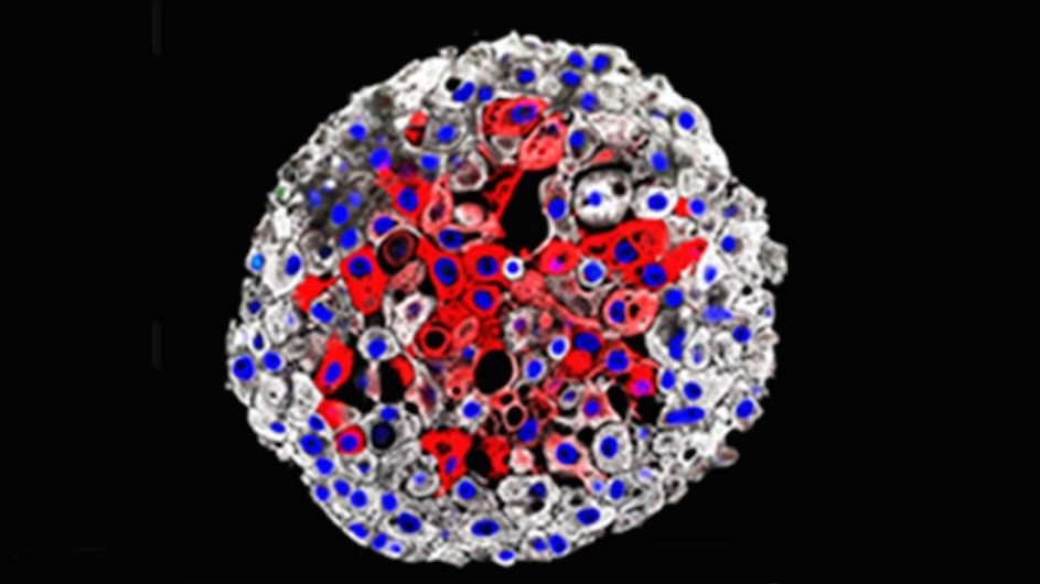 Bladder cancer organoids