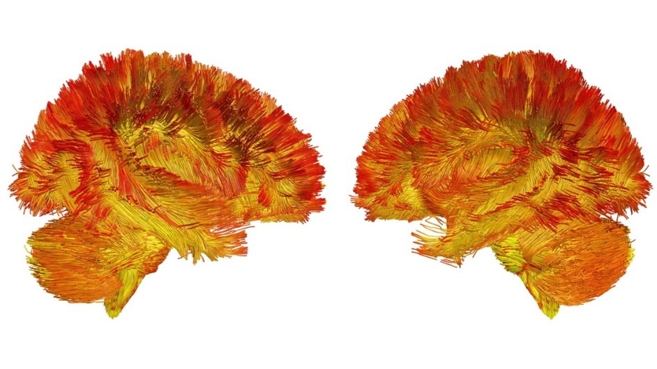 An illustration of two brains.