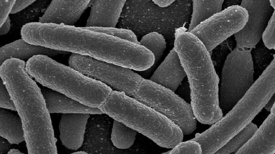 E. coli bacteria