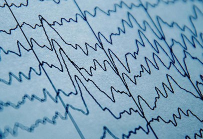 EEG Scan Squiggly lines across a sheet of paper.