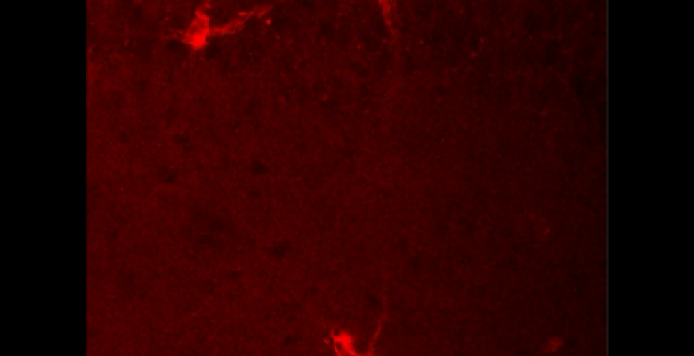 Neurons in red dye