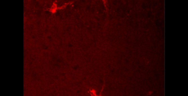 3-D confocal fluorescence imaging showing the links between the neurons over multiple regions in the brain in the BBB-opened region. Neurons in red dye
