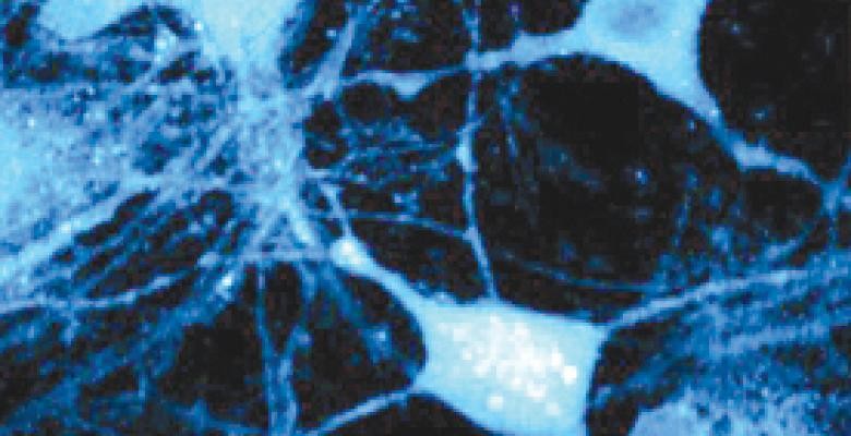 An image of newly synthesized proteins in live hippocampal neurons. mage by Lu Wei, Columbia University A protein dyed blue