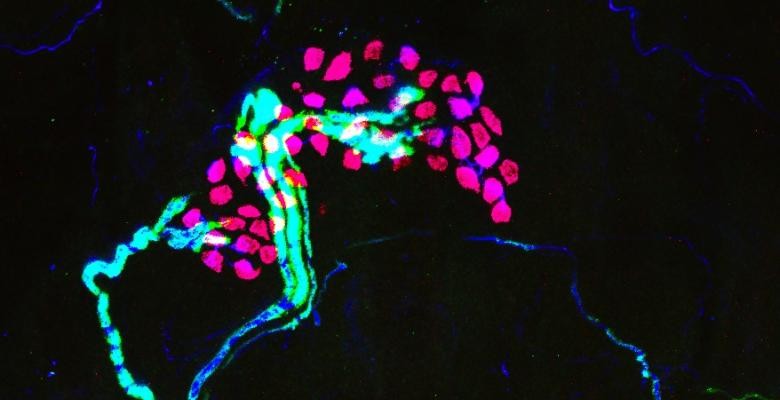 Pink Merkel cells and blue neurons