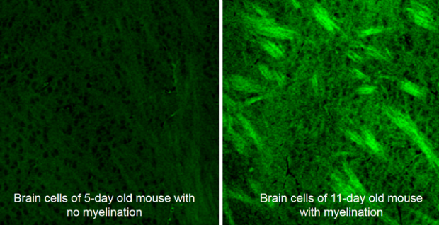 Using deuterium-labeled SRS imaging, researchers watched the brain cells of developing mice rapidly put on fat in a process called myelination. The ability to detect normal and abnormal myelination could help in detecting head injuries and monitoring the progression of multiple sclerosis. (Min lab/Columbia)