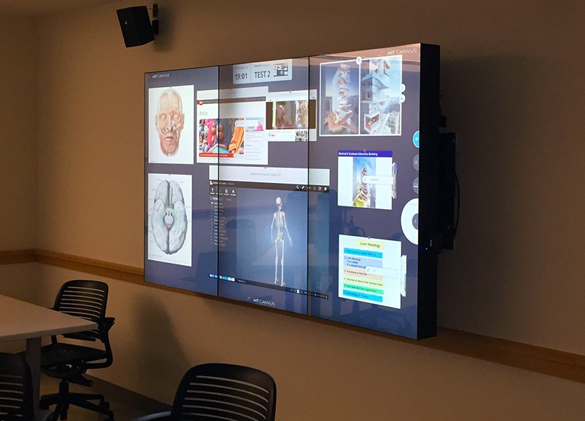 A big-screen monitor hangs on a wall, displaying several images of human anatomy.