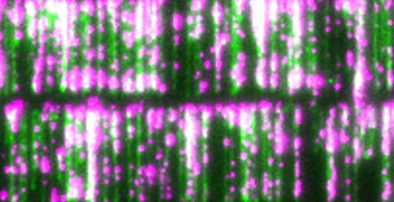 DNA curtains—devised by P&S professor Eric Greene—provide a new way to study DNA-protein interactions. DNA strands are green; proteins are pink. Image: Eric Greene. Pink and green dyed DNA