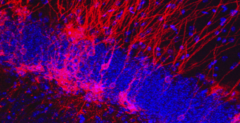 Neurons painted red