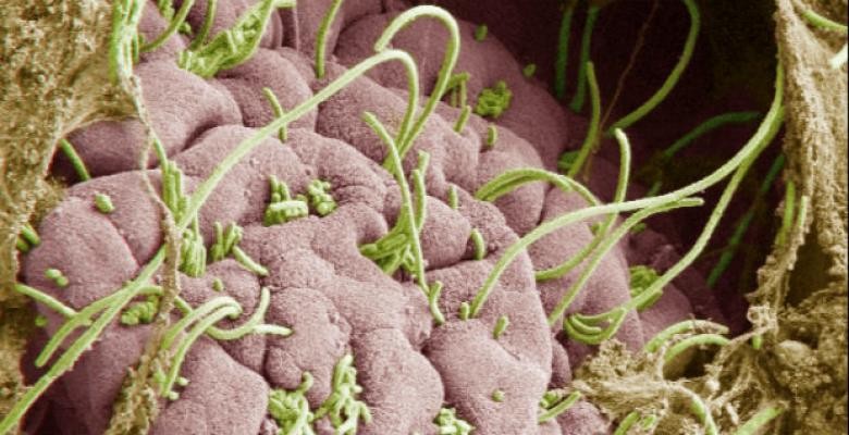 Ivaylo Ivanov is studying how commensal bacteria (green) interact with intestinal tissues (pink) to activate immune cells in the gut to fight infection. Image courtesy of Ivanov. Close up of stomach lining