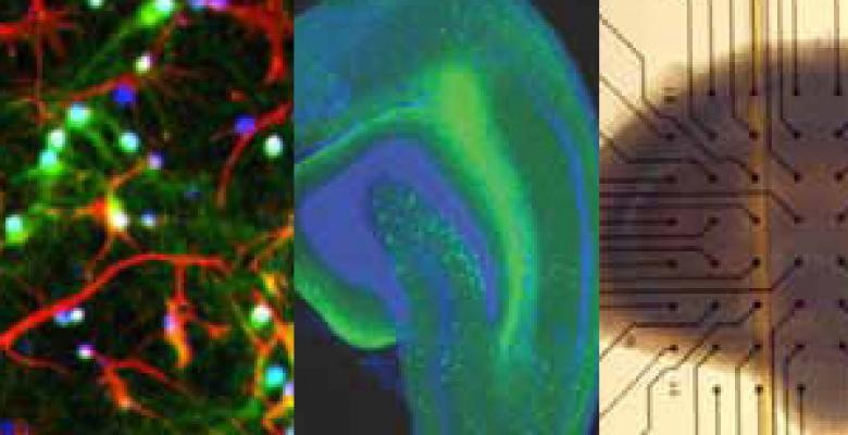 Images of various preparations used to study traumatic brain injury in Barclay Morrison's laboratory. Left: a mixed culture of brain cells stained for neurons (green) and auxiliary brain cells (red). Center: a hippocampal slice stained for inhibitory neurons (green). Right: a living hippocampal culture on a microelectrode array (black dots) to record neuronal activity after injury. Cells dyed green