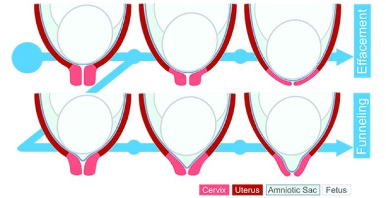 illustration of a cervix's mechanical movements