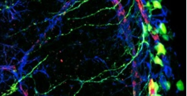 Neural stem cells detaching from the vascular niche. Image credit: Anna Lasorella, CUMC /Nature Cell Biology Green stem cells in a blue background
