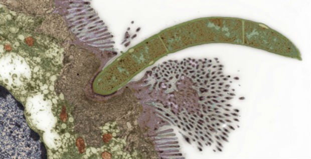 Microbe burrowing into gut cells