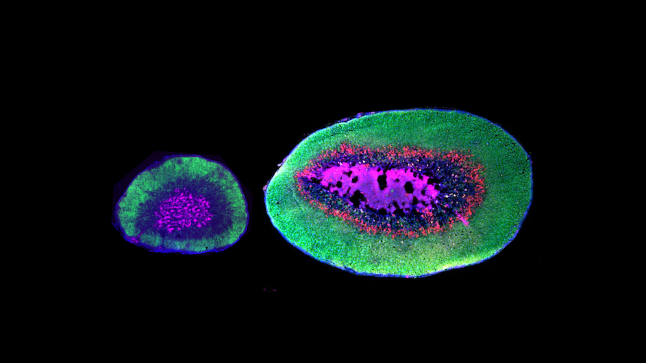 The adrenal glands of a deer mouse (left) and oldfield mouse (right).