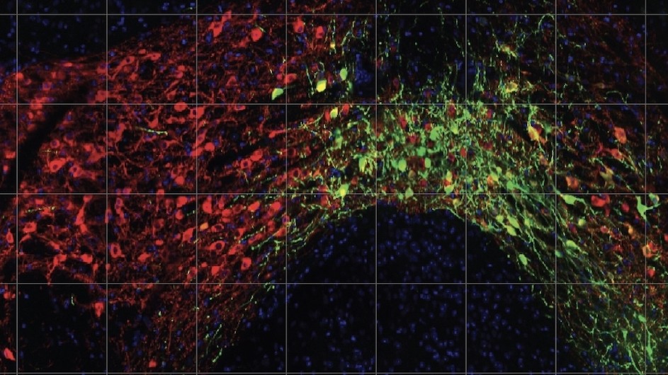 Dopamine neurons in the brain of a mouse.