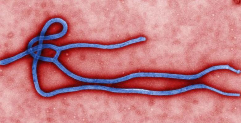 Colorized transmission electron micrograph of the Ebola virus virion. Credit: CDC/ Cynthia Goldsmith.