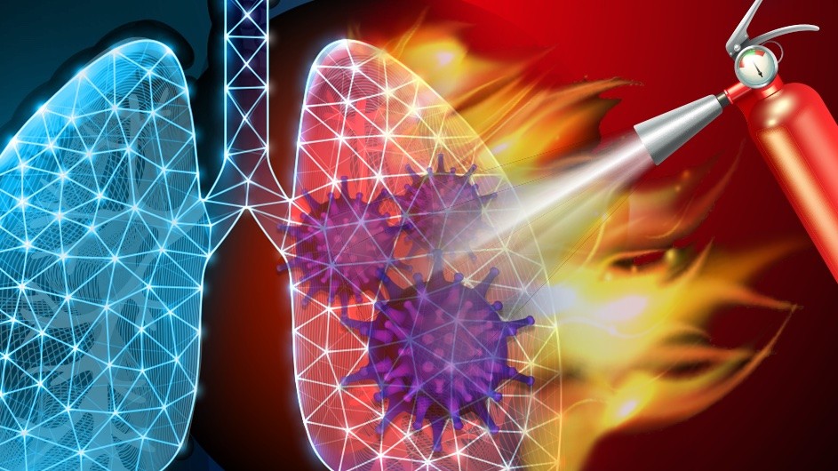 An illustration of ferroptosis in the lungs of a COVID-19 patient.