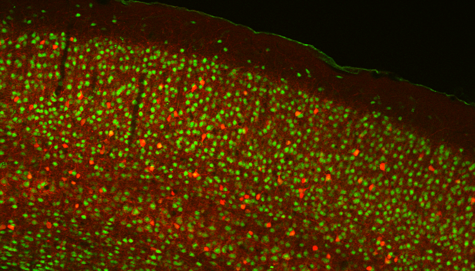 The human brain has billions of neurons. Classification of these diverse cells could help decipher how the brain works and what causes it to go awry. Pictured is an image of a mouse cortex. Excitatory neurons are shown in green and Inhibitory neurons in red. Credit: Yuste Lab, Columbia University tiny dots of green, red on brown background