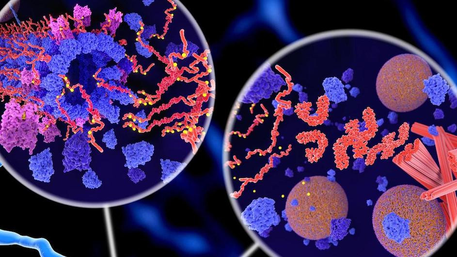 Pathological Tau protein (red-orange) phosphorylation (yellow) leads to disintegration of microtubuli and aggregation to neurofibrillary tangles  (orange) in a neuron axon. The transport of synaptic vesicles(spheres) is disrupted.