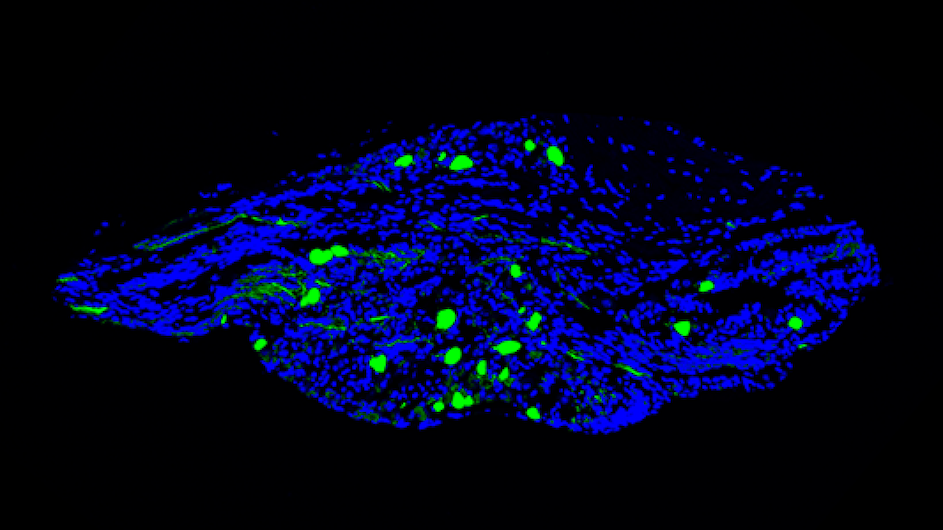 Credit: Mengtong Li / Zuker lab / Columbia's Zuckerman Institute. Vagal neurons that carry signals from the gut to the brain.