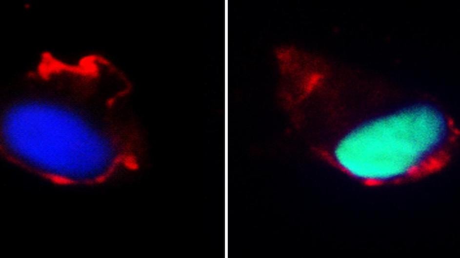 Images of cells from a well-rested (left) and sleep-deprived individual showing greater oxidative stress (green fluorescence) in the sleep-deprived cells.