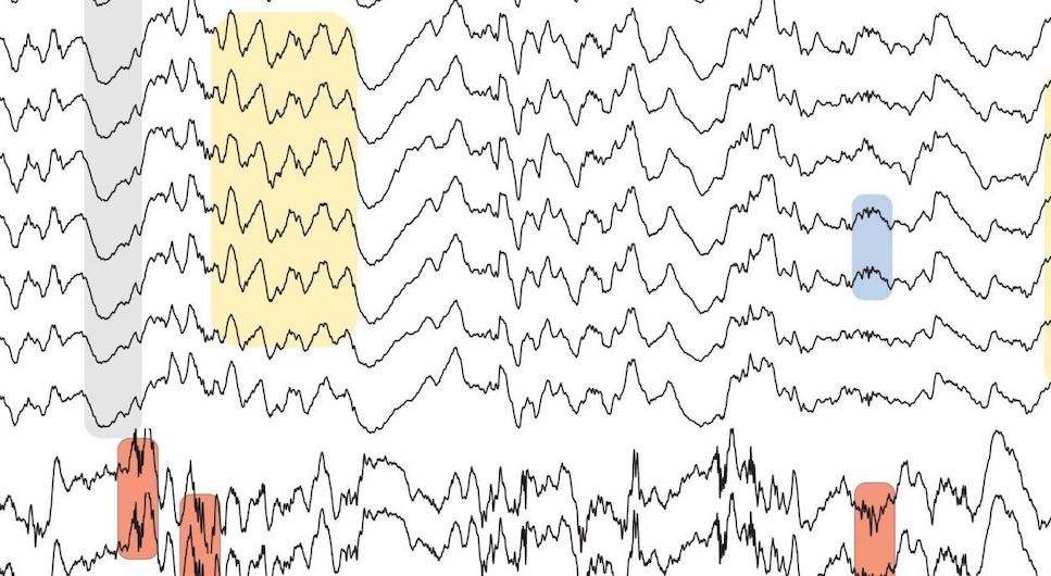 Multiple trace recording of oscillations in brain activity