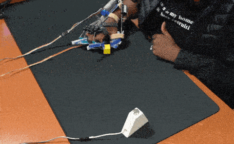 Stroke survivor using AI-powered robotic device to move hand.